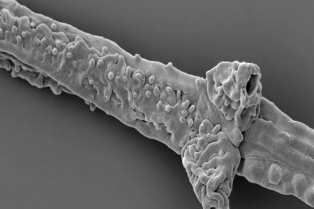 Ταπεινός μύκητας είναι ο αρχαιότερος γνωστός άποικος της ξηράς