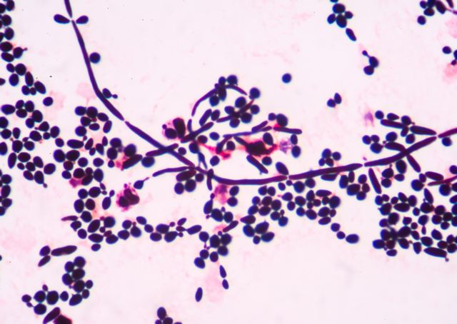 «Σπιτική» μορφίνη με τον παρεξηγημένο μύκητα!