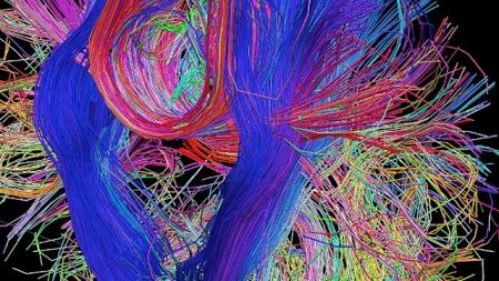 Κοινές αλλαγές στον εγκέφαλο σε τρεις νευροαναπτυξιακές διαταραχές