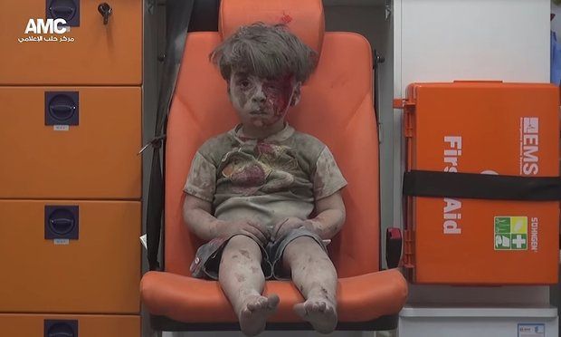Το αγόρι στο ασθενοφόρο σύμβολο του πολέμου στη Συρία (βίντεο)