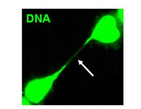 Έλληνες ανακάλυψαν μηχανισμό που προστατεύει από τη δημιουργία καρκίνου