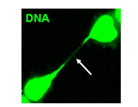Έλληνες ανακάλυψαν μηχανισμό που προστατεύει από τη δημιουργία καρκίνου