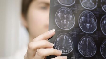 Νέος τρόπος πρόγνωσης του κινδύνου εκδήλωσης καρδιακής νόσου