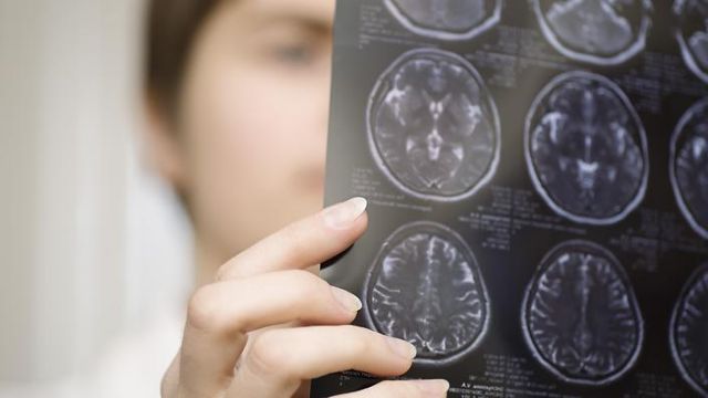 Νέος τρόπος πρόγνωσης του κινδύνου εκδήλωσης καρδιακής νόσου