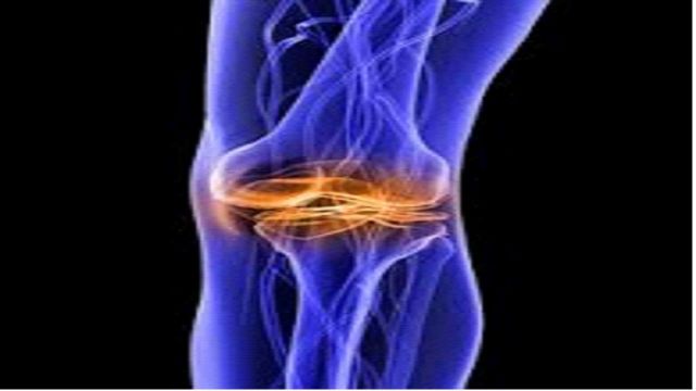 Εξατομικευμένη αρθροπλαστική γόνατος