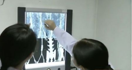 Τρισδιάστατα εκτυπωμένα αιμοφόρα αγγεία μεταμοσχεύθηκαν επιτυχώς σε μαϊμούδες