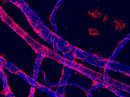 Κύτταρα των αιμοφόρων αγγείων σχηματίζουν όγκους