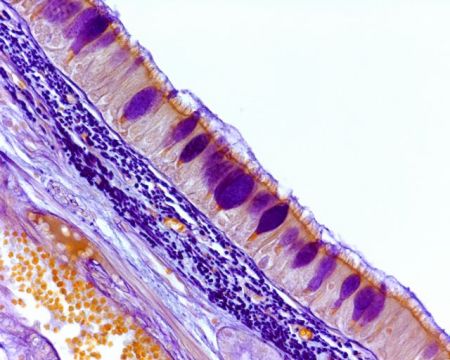 Ενας (βραβευμένος) Ελληνας ενάντια σε πολλές γενετικές νόσους