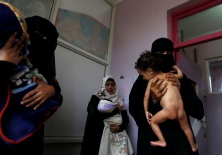 Υεμένη: Σχεδόν 2 εκατ. παιδιά υποφέρουν από οξύ υποσιτισμό