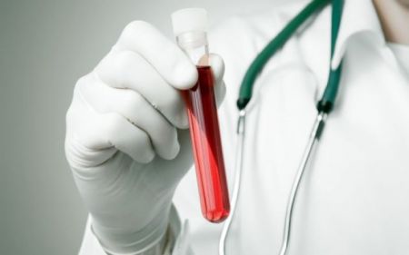 Νέο αιματολογικό τεστ προβλέπει την εξέλιξη της Πολλαπλής Σκλήρυνσης