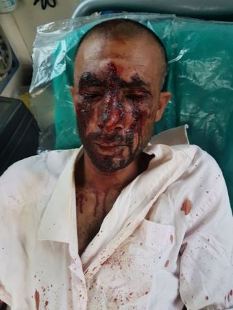 Τρεις συλλήψεις για τη ρατσιστική επίθεση στον Ασπρόπυργο