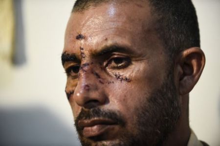 Τρεις ταυτοποιήσεις για τη ρατσιστική επίθεση στον Ασπρόπυργο