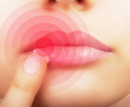 Μην αφήσεις να σε… ζώσει ο έρπης, ο πόνος, η ταλαιπωρία