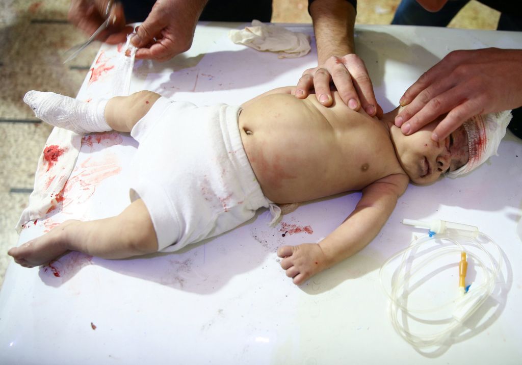 Συρία: Ανησυχητική κρίση παιδικού υποσιτισμού