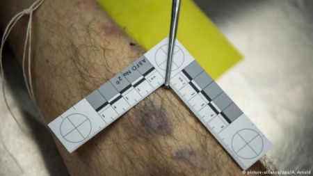 DW: Πιθανά εγκλήματα ή ιατρικά λάθη στο σκοτάδι από επιπόλαιες νεκροψίες