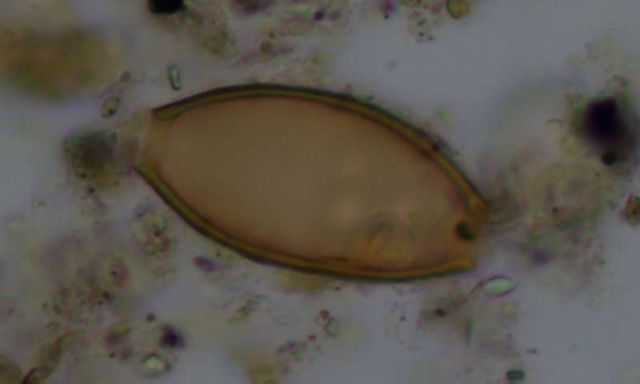 Ανακαλύφθηκαν τα παρασιτικά σκουλήκια που περιέγραφε ο Ιπποκράτης