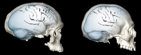 Το σφαιρικό σχήμα του ανθρώπινου εγκεφάλου εξελίχθηκε σταδιακά
