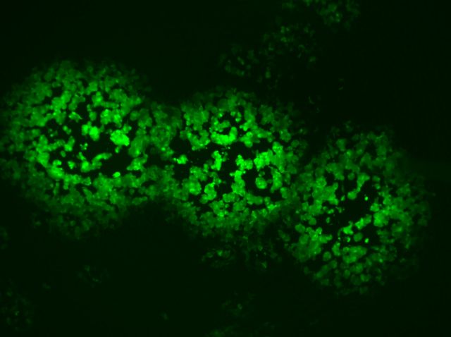 Φυσικό συστατικό εμποδίζει την εξάπλωση των ιών [Βίντεο]