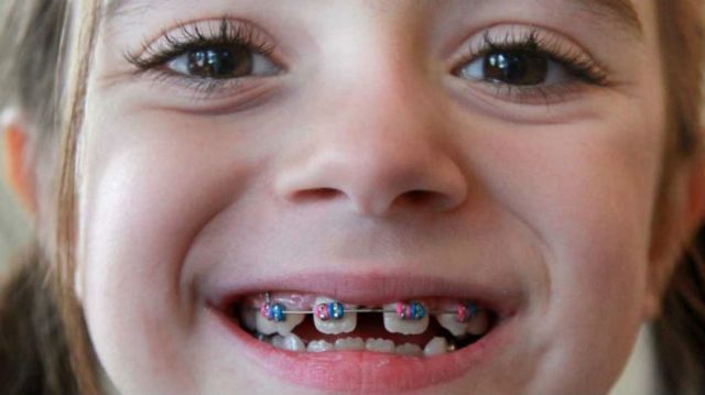 Ιδιαίτερης σημασίας η πρώτη επίσκεψη του παιδιού στον οδοντίατρο