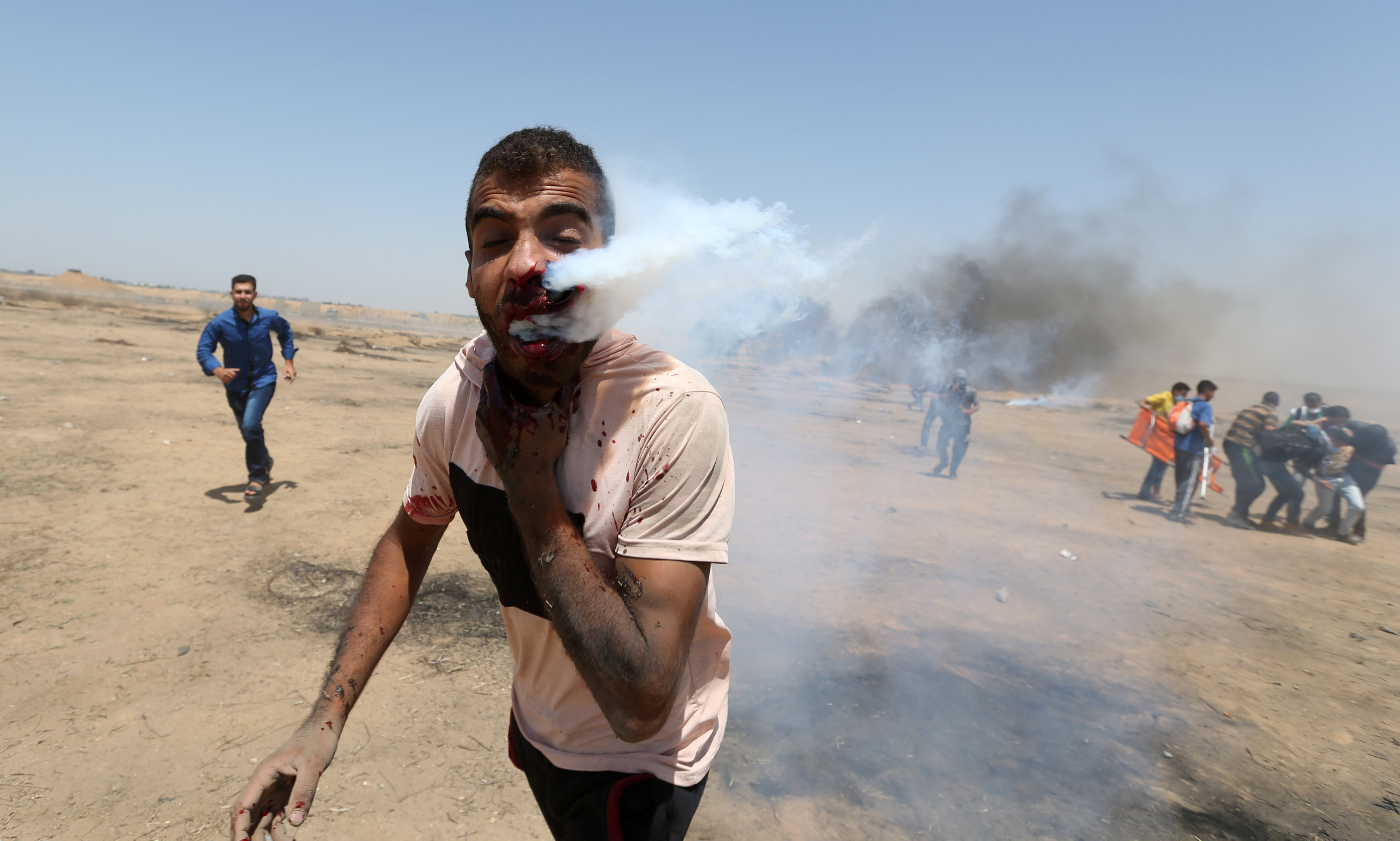 Γάζα: Τρεις νεκροί απο ισραηλινά πυρά – Εκατοντάδες τραυματίες