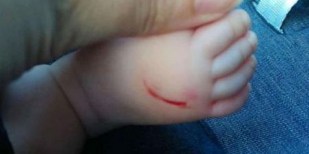 Την Παρασκευή η δίκη της 55χρονης που φέρεται να χαράκωνε μωρά