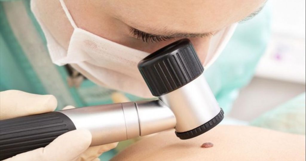 Αυξήθηκαν οι θάνατοι από καρκίνο του δέρματος στους άνδρες – Που καταγράφεται η μεγαλύτερη θνησιμότητα