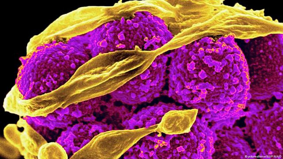 Τα ανθεκτικά μικρόβια αιτία θανάτου