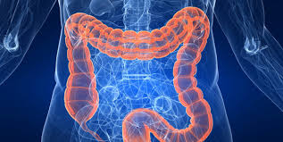 «Φως» στο γενετικό υπόβαθρό του καρκίνου του παχέος εντέρου