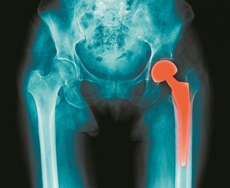 «Το σκάνδαλο των εμφυτευμάτων» και η ερευνητική δημοσιογραφία