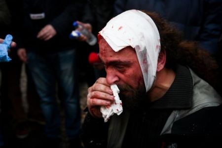 Δολοφονική επίθεση σε φωτορεπόρτερ στο συλλαλητήριο