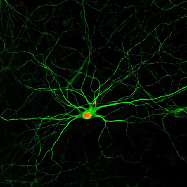 «Χάπι» θα αναγεννά νευρώνες στον εγκέφαλο