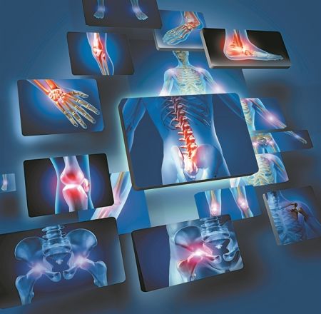 Η αρχή του τέλους για την οστεοαρθρίτιδα