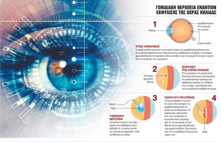 Γονιδιακή θεραπεία εναντίον τύφλωσης