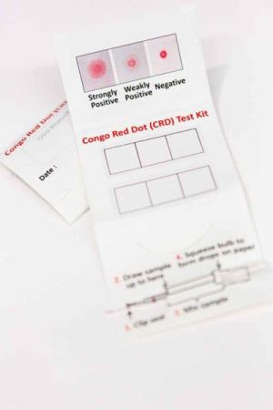 Τεστ ούρων ανιχνεύει την προεκλαμψία σε τρία λεπτά