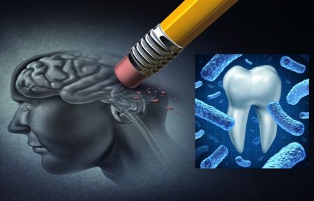 Πώς τα ούλα μας συνδέονται με τη νόσο Αλτσχάιμερ