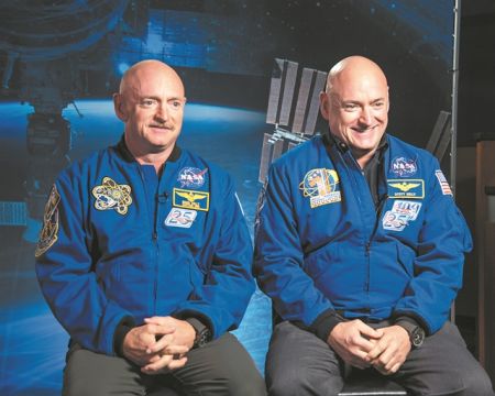 Τι συμβαίνει στο σώμα ύστερα από έναν χρόνο στο Διάστημα