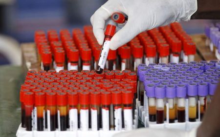 Για πρώτη φορά στην Ελλάδα θεραπεύτηκε ασθενής με μεσογειακή αναιμία