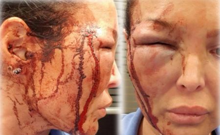 «Ο Μανώλης Παπαμακάριος με χαράκωσε και με γρονθοκόπησε» – Εικόνες σοκ