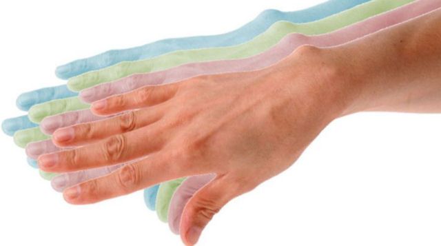 Πάρκινσον : Νέα στοιχεία δείχνουν ότι η νόσος περνά από… το έντερο