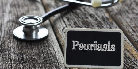 Πότε ο ήλιος κάνει καλό στην αντιμετώπιση της ψωρίασης