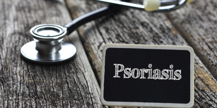 Πότε ο ήλιος κάνει καλό στην αντιμετώπιση της ψωρίασης