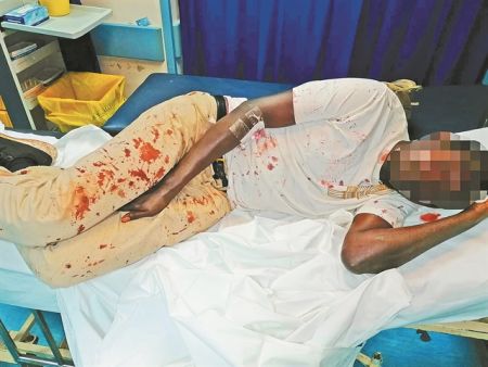 Η ρατσιστική βία γίνεται… συνήθεια