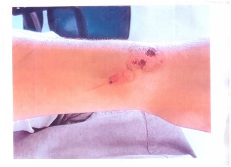 Σπουδαστής μαγειρικής καταγγέλλει βασανιστήρια εποχής Ιεράς Εξέτασης