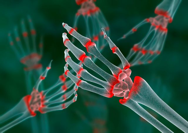 Ακόμη και παιδιά πλήττουν οι ρευματικές παθήσεις