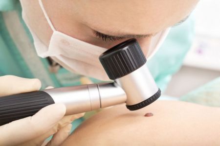 Καρκίνος του δέρματος :  Πιθανότερη η μετάσταση αν αναπτύσσεται πάνω από το λαιμό