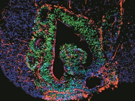 Τα οργανοειδή στο προσκήνιο