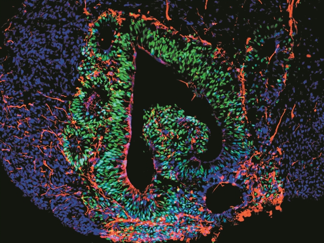 Τα οργανοειδή στο προσκήνιο