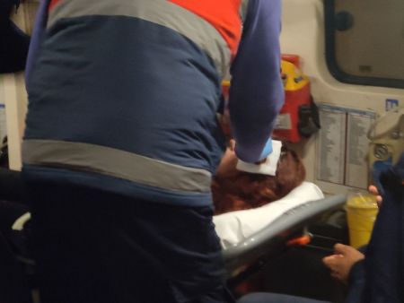 Εξάρχεια : Επίθεση από τα ΜΑΤ καταγγέλλει η 20χρονη που τραυματίστηκε στο κεφάλι
