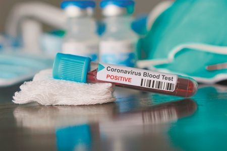 Αντι-ιικές οδηγίες και μέτρα προστασίας