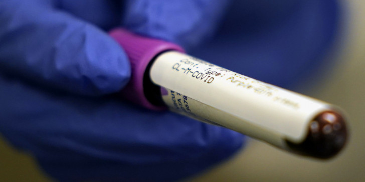 Κορωνοϊός: Τέλος από τον ΠΟΥ στις δοκιμές με υδροξυχλωροκίνη